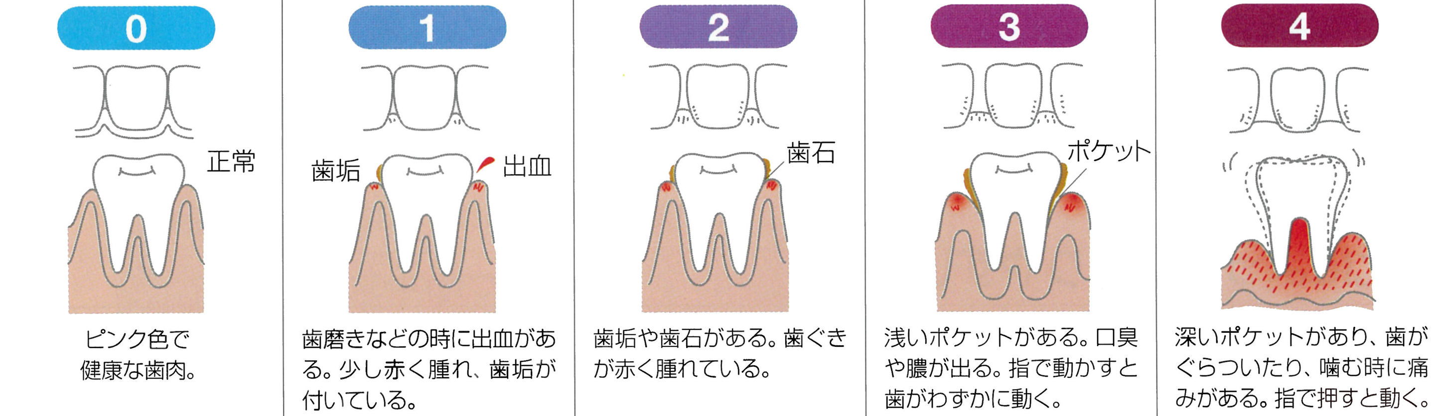 歯の健康２