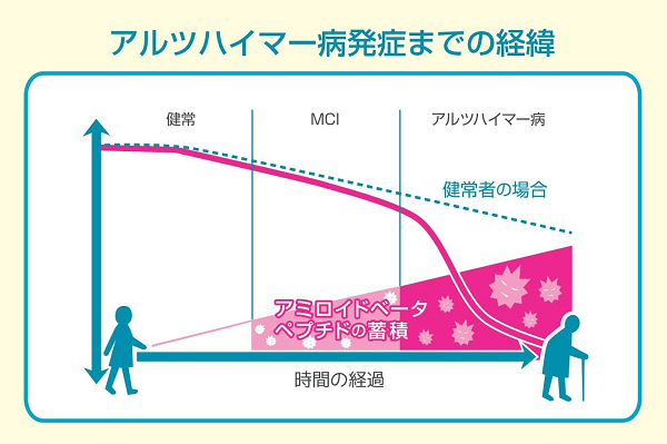 経緯