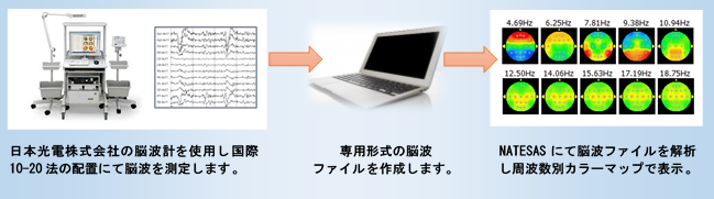 脳波変換図